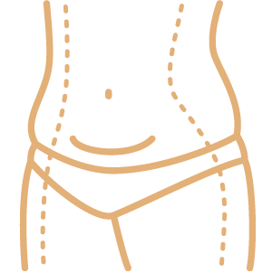 Abdominoplastia 